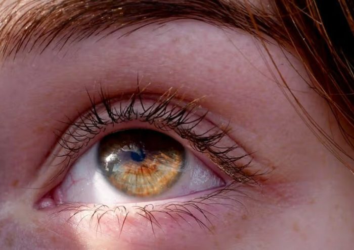 تغییری مخفی در چشمان شما می‌تواند اولین علامت کاهش شنوایی باشد